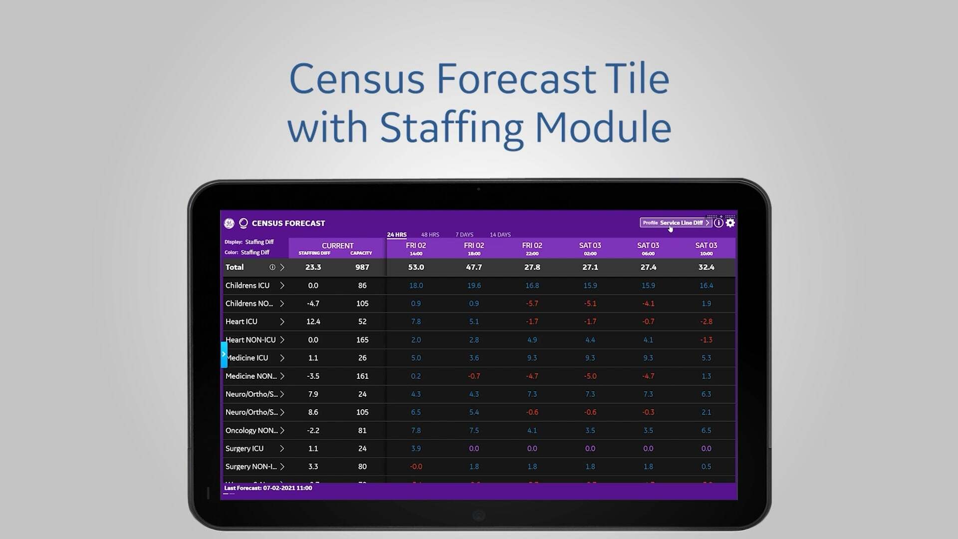 one-minute-census-forecast-staffing